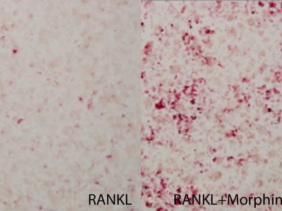 split screen image of red cells on a white background, with more on the side treated with morphine