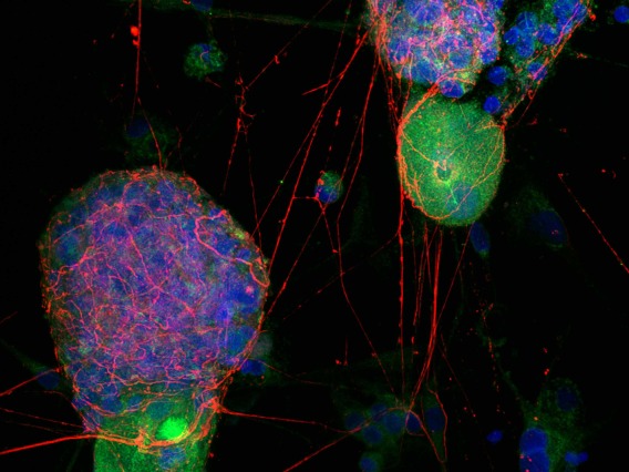 Colorful microscope image of male neurons and orexin receptors